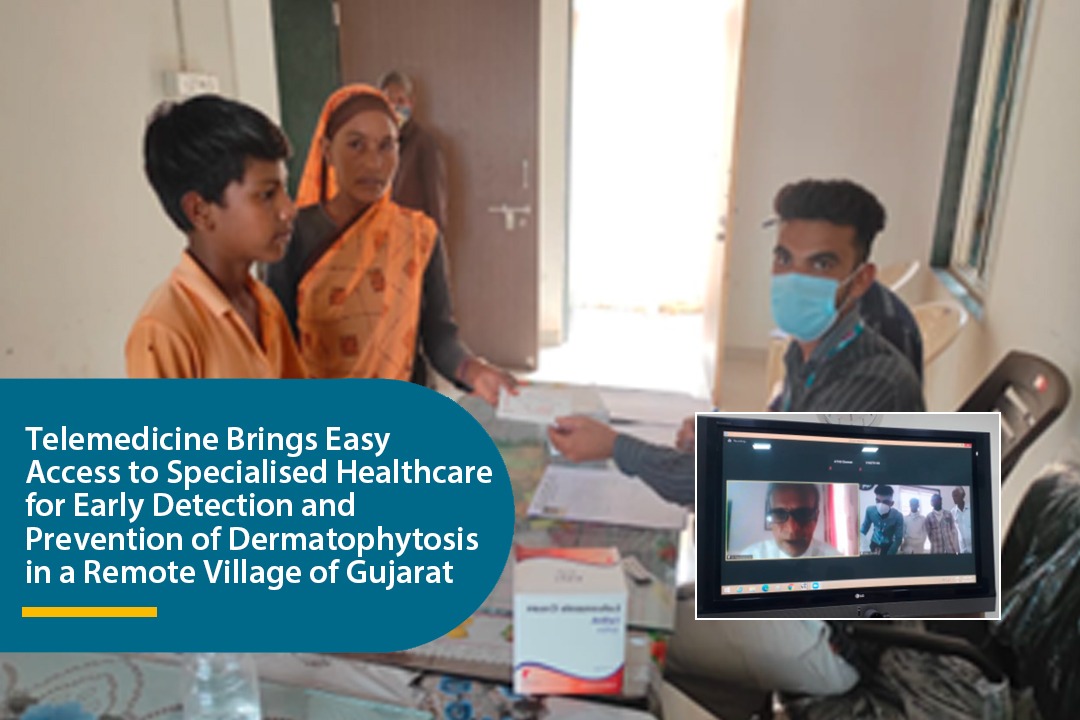 Telemedicine Brings Easy Access to Specialised Healthcare for Early Detection and Prevention of Dermatophytosis in a Remote Village of Gujarat