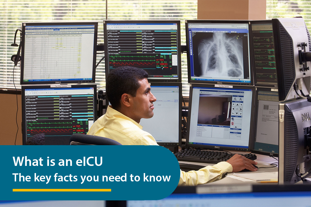 What is an eICU-The key facts you need to know