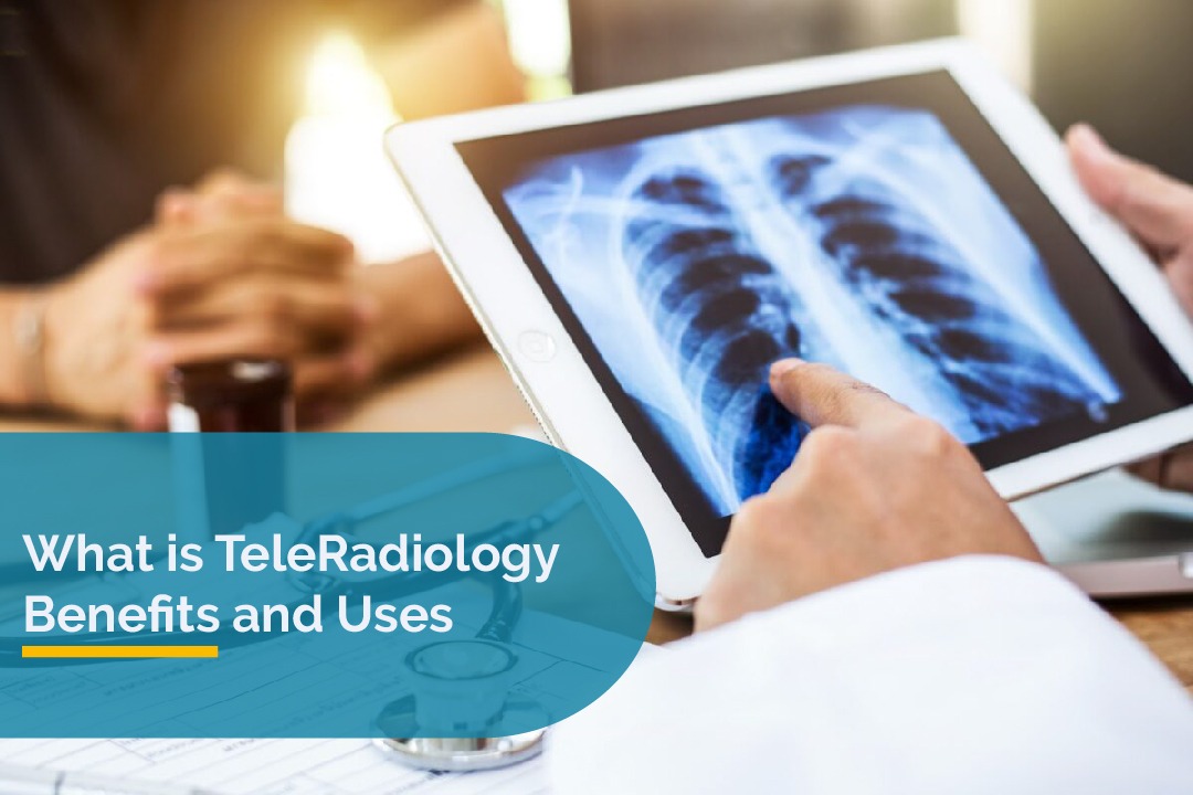 What is Teleradiology? Benefits and Uses